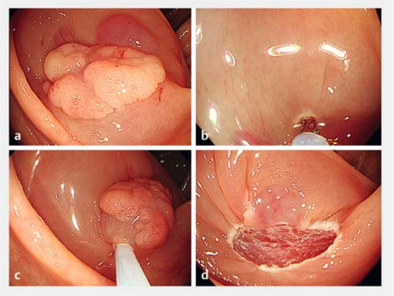 屏幕截图 2026-01-11 200851.png