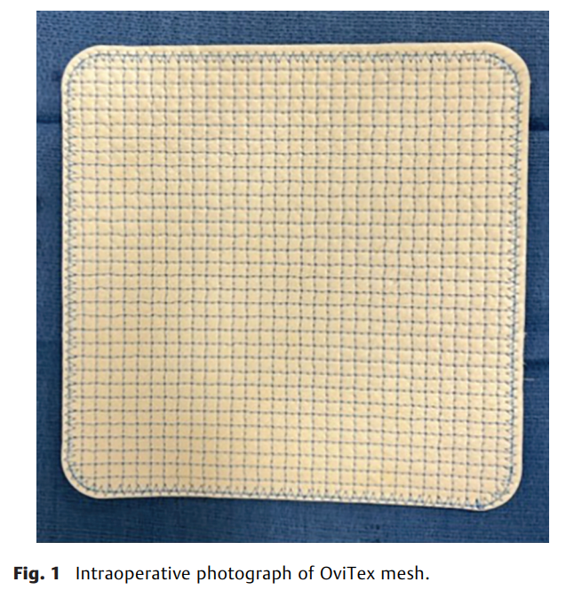 Abdominal Wall Reinforcement 2.png
