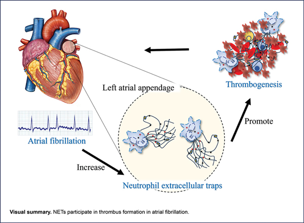 Neutrophil Extracellular.jpg