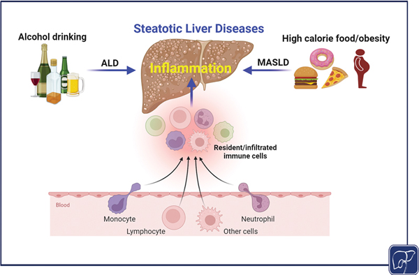 4-Inflammation in Steatotic.jpg