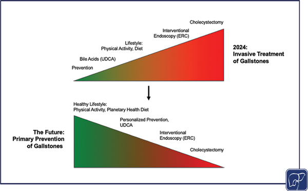 10-Gallstones Prevention.jpg