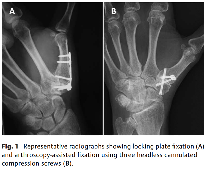 691ae4adc8be1.png How does Fixation Alignment .png