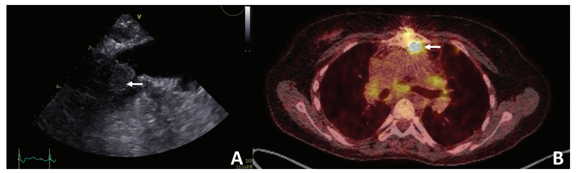697965cd3fae7.png 屏幕截图 2026-01-27 182415.png