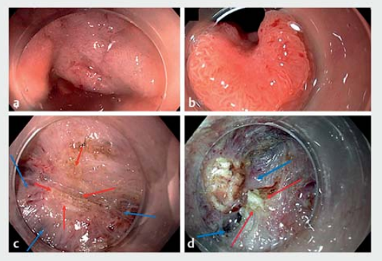 69a5349d9ca05.png 屏幕截图 2026-02-28 100214.png