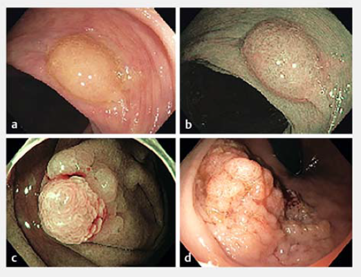 屏幕截图 2026-03-09 101522.png