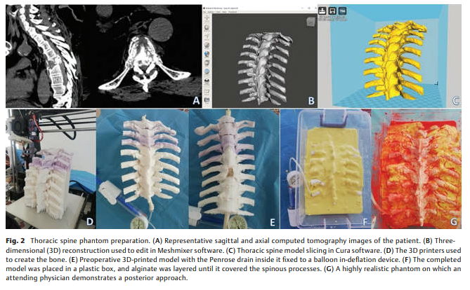 Patient-Specific Highly 2.png