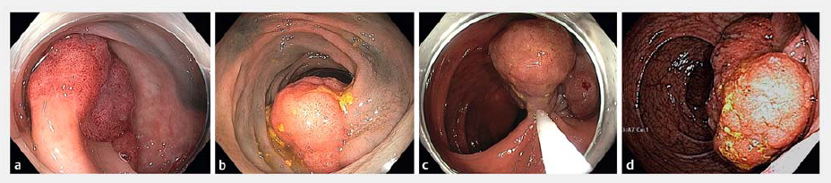 69b77d4d45004.png 屏幕截图 2026-03-16 105321.png