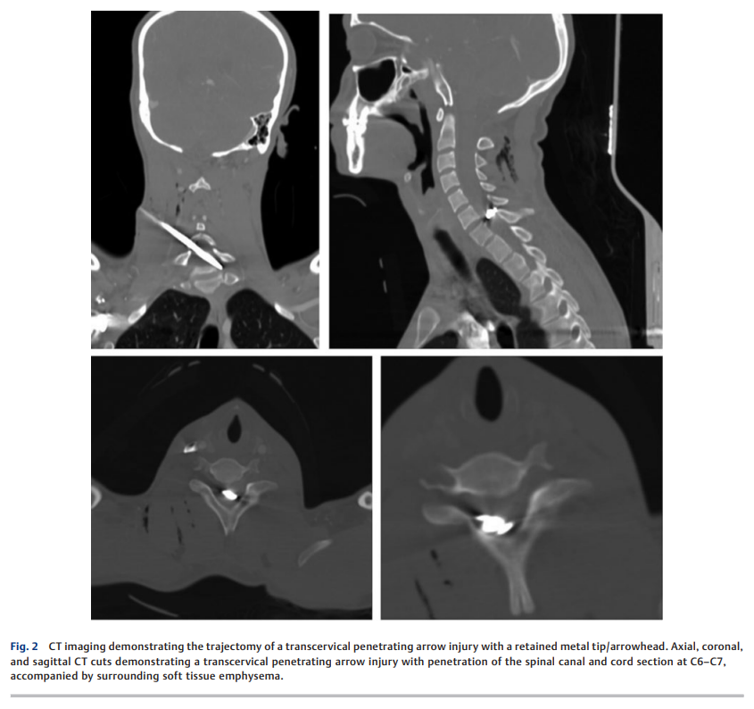 A Unique Case of 2.png