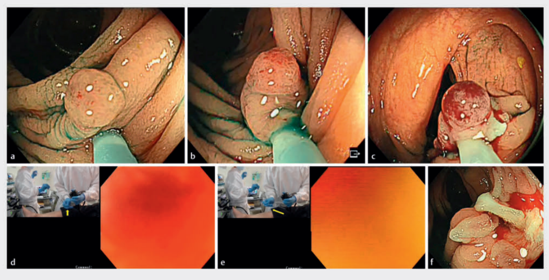 屏幕截图 2026-03-23 084505.png