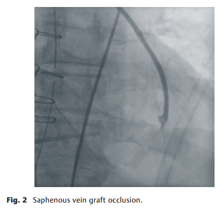 69e075063146e.png 屏幕截图 2026-04-02 113847.png