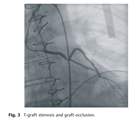 69e0750d46fcf.png 屏幕截图 2026-04-02 113855.png