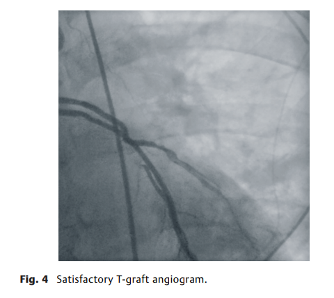 69e07513a4bea.png 屏幕截图 2026-04-02 113905.png