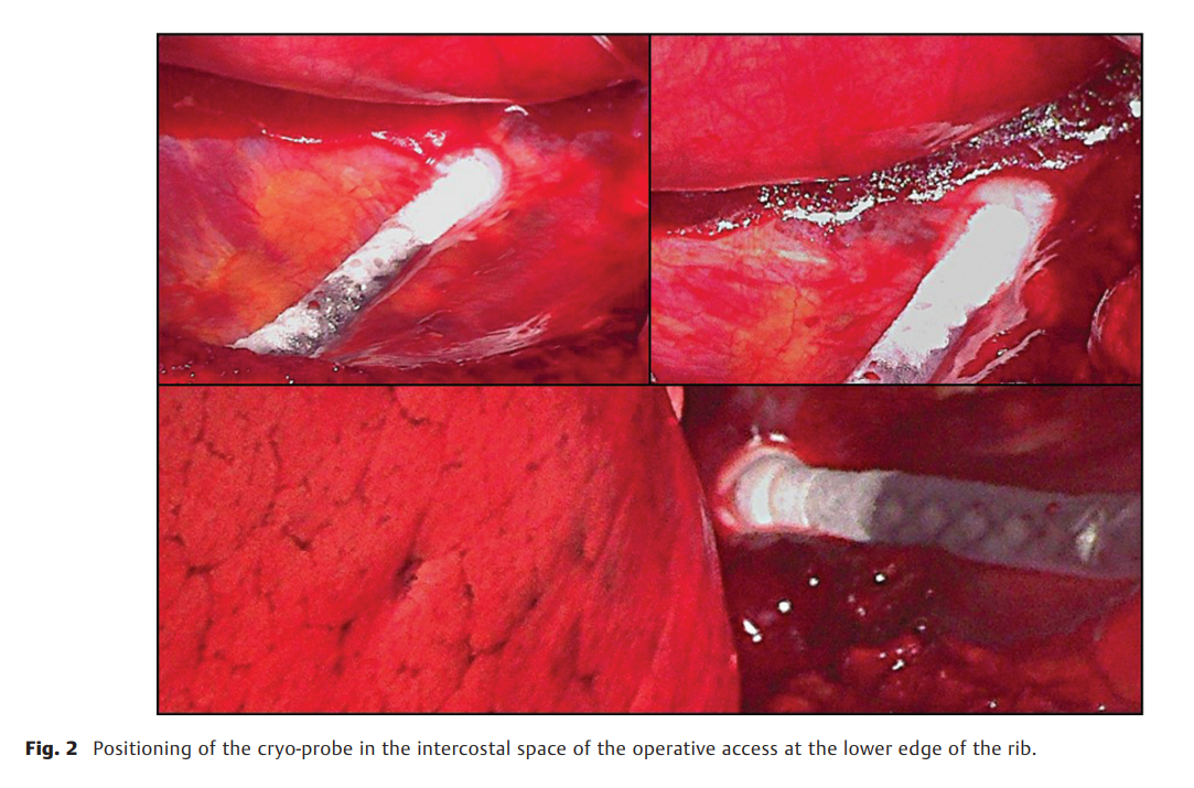屏幕截图 2026-04-21 102458.png