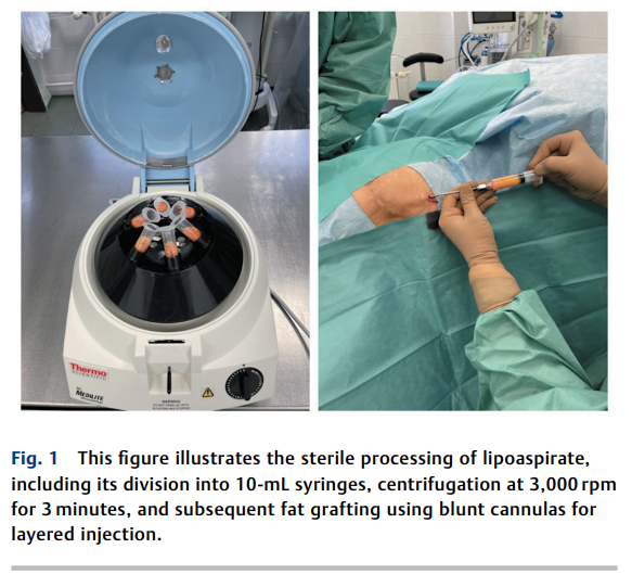 Prevention of Pressure Sore Recurrence 2.png