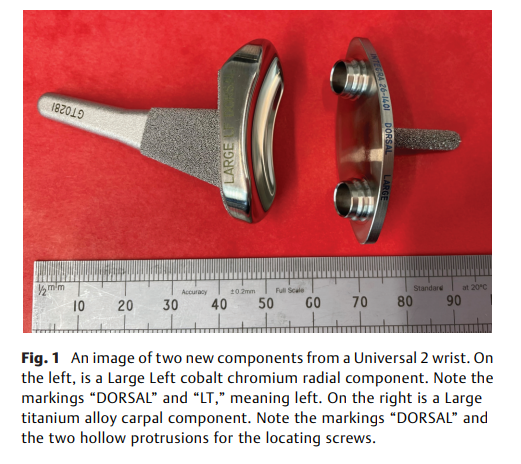 Failure of Universal 2 Wrist Joint .png